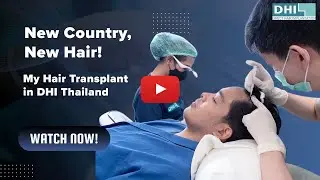 New Country, New Hair My Hair Transplant in DHI Thailand I DHI Original Technique