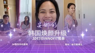 Anna的3D打印亚洲隆鼻之旅 | INNOFIT肋软骨 | 第一章 @ JW整形外科