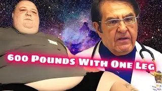 James LB Bonner The Missing Episode - My 600 Pound Life Reaction