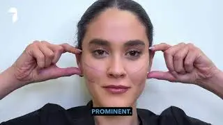How Temple Filler Lifts and Balances Your Face