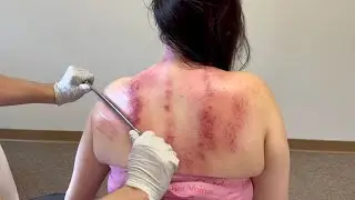 ASMR RELAXING HEAD TO TOE CHIRO TREATMENT