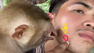 Squeeze Acne!! Adorable Give New Skin Care for Me after Groom