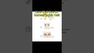 Lice that live in human pubic hair #shrots