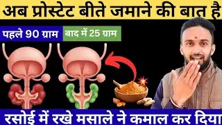 🤯Prostate Enlargement का काल है ये मसाला|How To Reduce Your Enlarged Prostate Naturally(Doctor Tips)