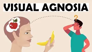 What is Visual Agnosia? 10 Things You Need to Understand
