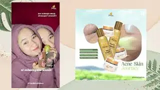 Testimoni Acne Series - Helwa Beautycare