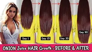 Onion Juice Hair Growth Challenge: Before & After Results 🧅✨