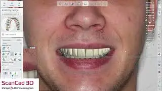 3shape uaox 06-27-2025