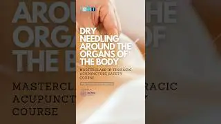 FREE COURSE in Thoracic Acupuncture Safety #dryneedling #manualtherapy