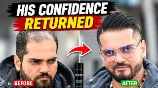 MAKEOVER: Thinning & Balding Haircut
