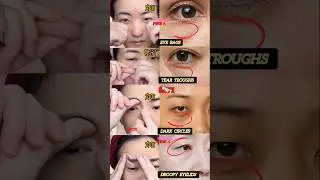 04 Actions To Solve All Eye Problems 😱 #yoga #eyebrows #eyes #korean #skincare #faceyoga #shorts