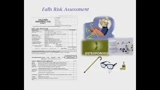 FALL RISK ASSESSMENT FOR OSCE