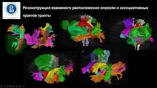 Школа молодых учёных: Яшин К.С. - Трансляционная нейроонкология
