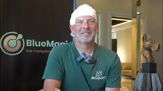 What Really Happens BEFORE a Hair Transplant