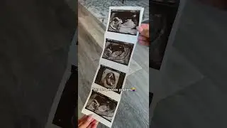 Lien en bio 🔗 Appel &agrave; tous les parents🥹🥰 #cadeaudenaissance #echographie #futuremaman