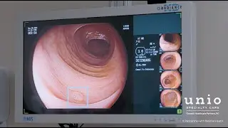 SKOUT Video for Physicians - AI-Assisted Colonoscopies