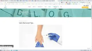 How To Install Disqus.com Commenting on a Joomla K2 or Articles?