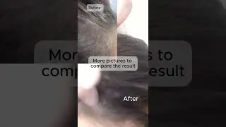 White Hair to Black Hair- Naturally, No Chemicals 100 % Result