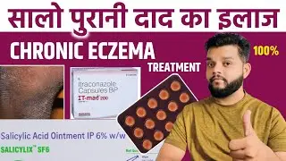 सालों पुराने दाद का सम्पूर्ण इलाज / Chronic Eczema Allopathic Treatment In Hindi / Fungal Infection