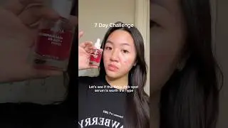 7 day challenge with Anua dark spot correcting serum!!