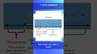 T-Score Explained