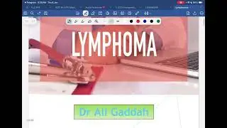 Lecture 17 - Lymphoma - Dr. Ali