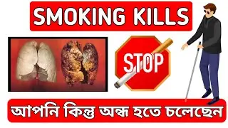 Smoking Kills it causes Blindness | Smoking make you Total Blind | smoking | optometrist eye health