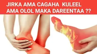 #CAGA HURKA SIDA UGU FUDUD EE LOO DAAWEEYN KARO CAGA HURKA AMA CAGA OLOLKA ???