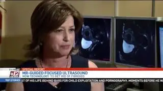 Curawave on CBS12 11:00PM News