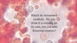 What blood looks like under microscope, 1000x