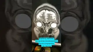 rezonans magnetyczny głowy