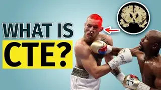 What is CTE #shorts