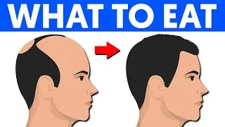 Prevent Hair Loss By Eating These 10 Foods
