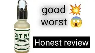 Zit Fix Tea Tree Serum Review | My Honest Personal Experience ( Acne-Prone Skin)|Rumi awan official