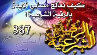 كيف نعالج مصابي الإيدز بالرقية الشرعية؟ - 387