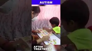 Cell Therapy Success Story Improved Understanding and ABCD Matching at Age 5 | West Bengal