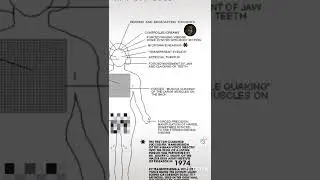Havana syndrome Technology
