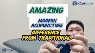 SPORT INJURY | YOU MUST KNOW | MODERN | ACUPUNCTURE  | PAINLESS NEEDLES | CHINESE MEDICINE