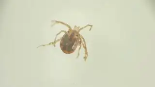 Water mite-Hydrachnidia Under a Microscope | Stock Footage - Videohive