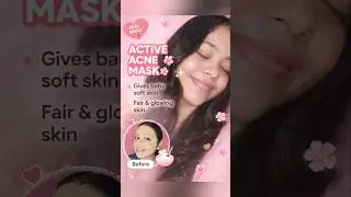 #shorts ACNE PRONE SKIN 😭🥲 Home made face mask #skincare