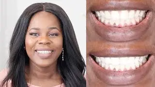 Whitening Sensitive Teeth at HOME! + GIVEAWAY || TheAdeTomi