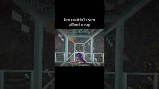 bro couldn't even afford x-ray