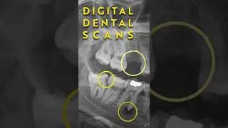 Digital Dental Scans: What They Tell Us About Your Smile