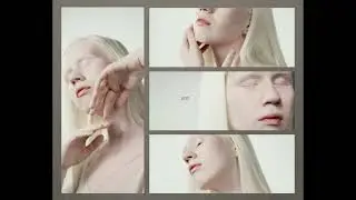 #Dayspotlight 13 JUNE 2023 Today in history #Albinism #InclusionIsStrength #AlbinismDay #albinismo