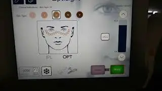 2023 Lumenis Optilight TLA5162 (2)
