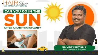 Sunlight After Hair Transplant: Dos & Don'ts | Expert Advice by Dr. Vinay