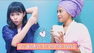 Best stretch mark cream removal recipe