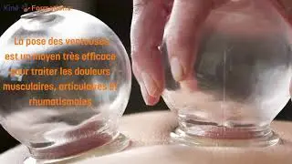 Technique des ventouses