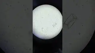 urine routine examination