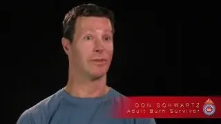 Burn Survivor Don Schwartz Talks About Recovery